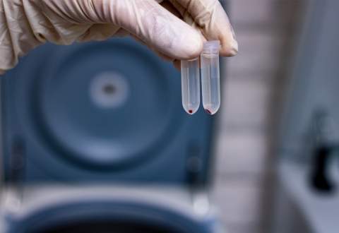 A hand is visible holding two vials. Each vial is filled with clear liquid and has a drop of blood visible at the bottom.